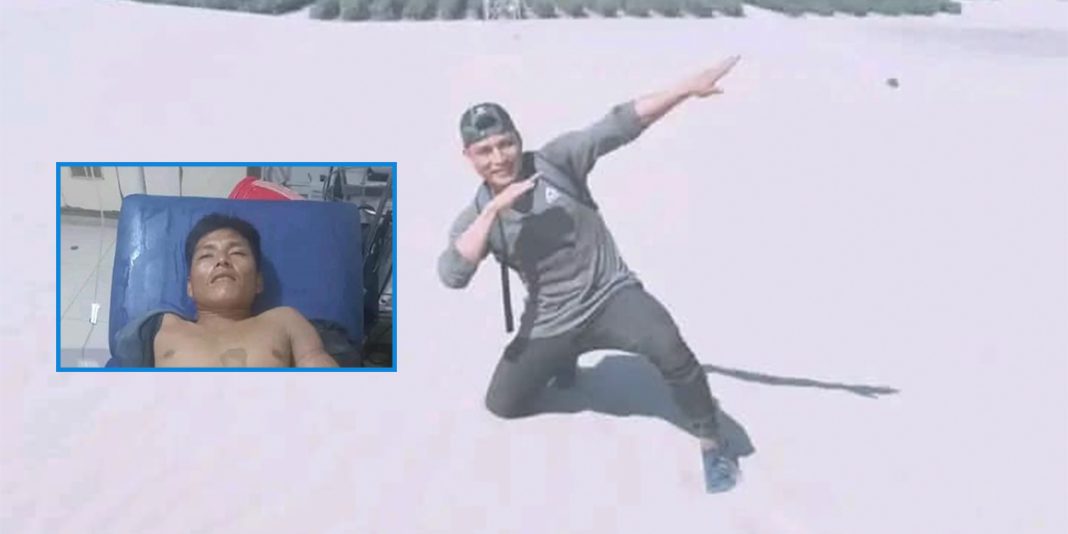 Ucayali: Joven recibió disparo en el brazo mientras cazaba