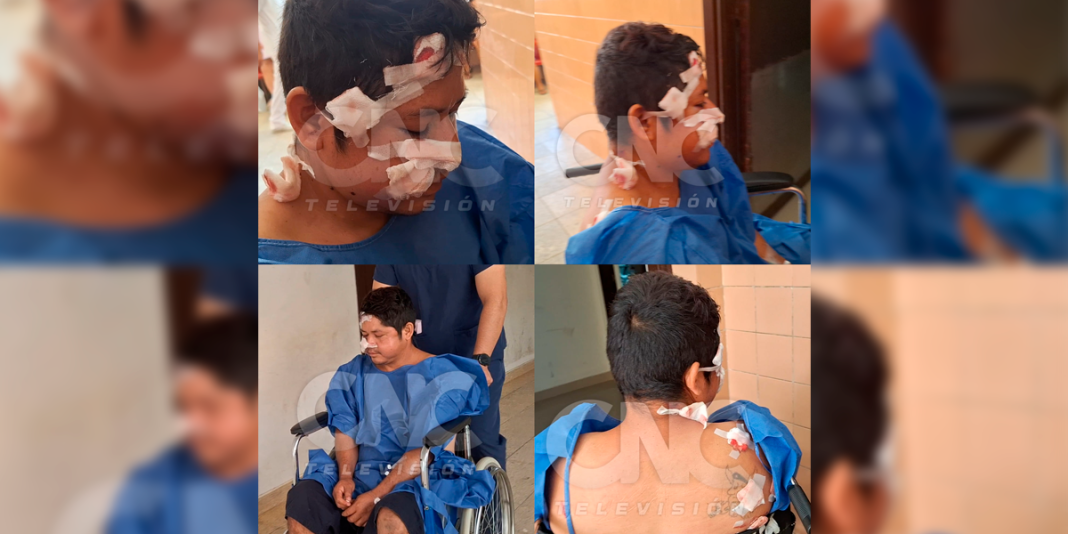 Loreto: Hombre resultó herido por disparo accidental durante caza