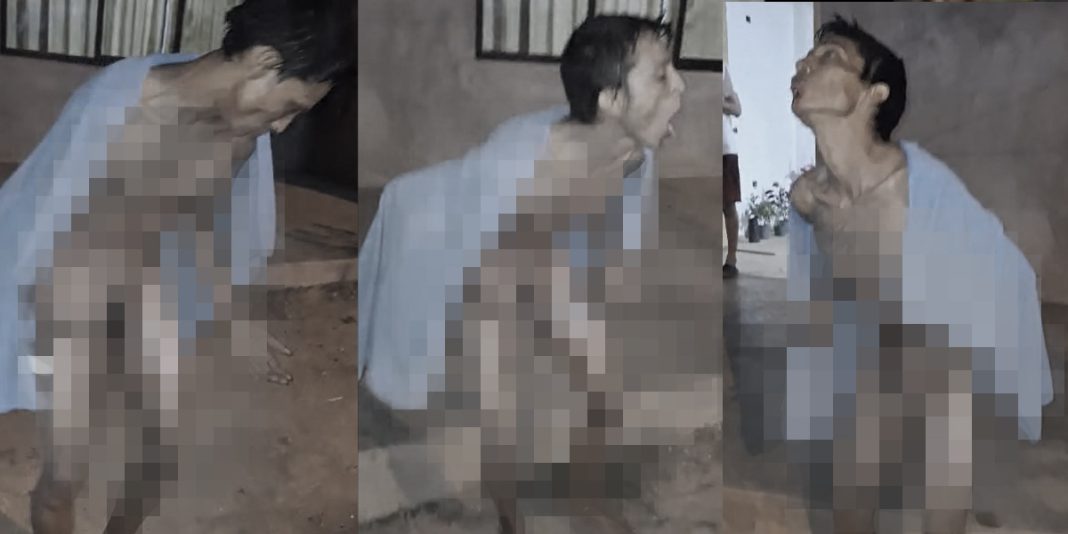 Consumidor de drogas sufre serias quemaduras en gresca con otro adicto