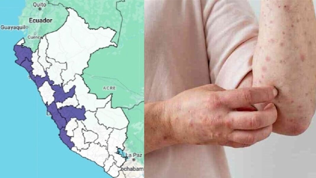 Perú Enfrenta Incremento de Casos y Posible Nueva Variante