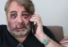 España: hombre sufre brutal golpiza tras pedir a jóvenes que no hicieran ruido